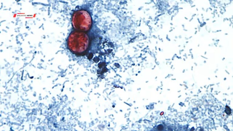 Parasite